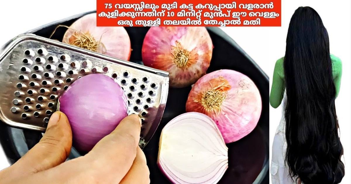 Better Hair Growth And Dandruff Relief Using Onion Juice